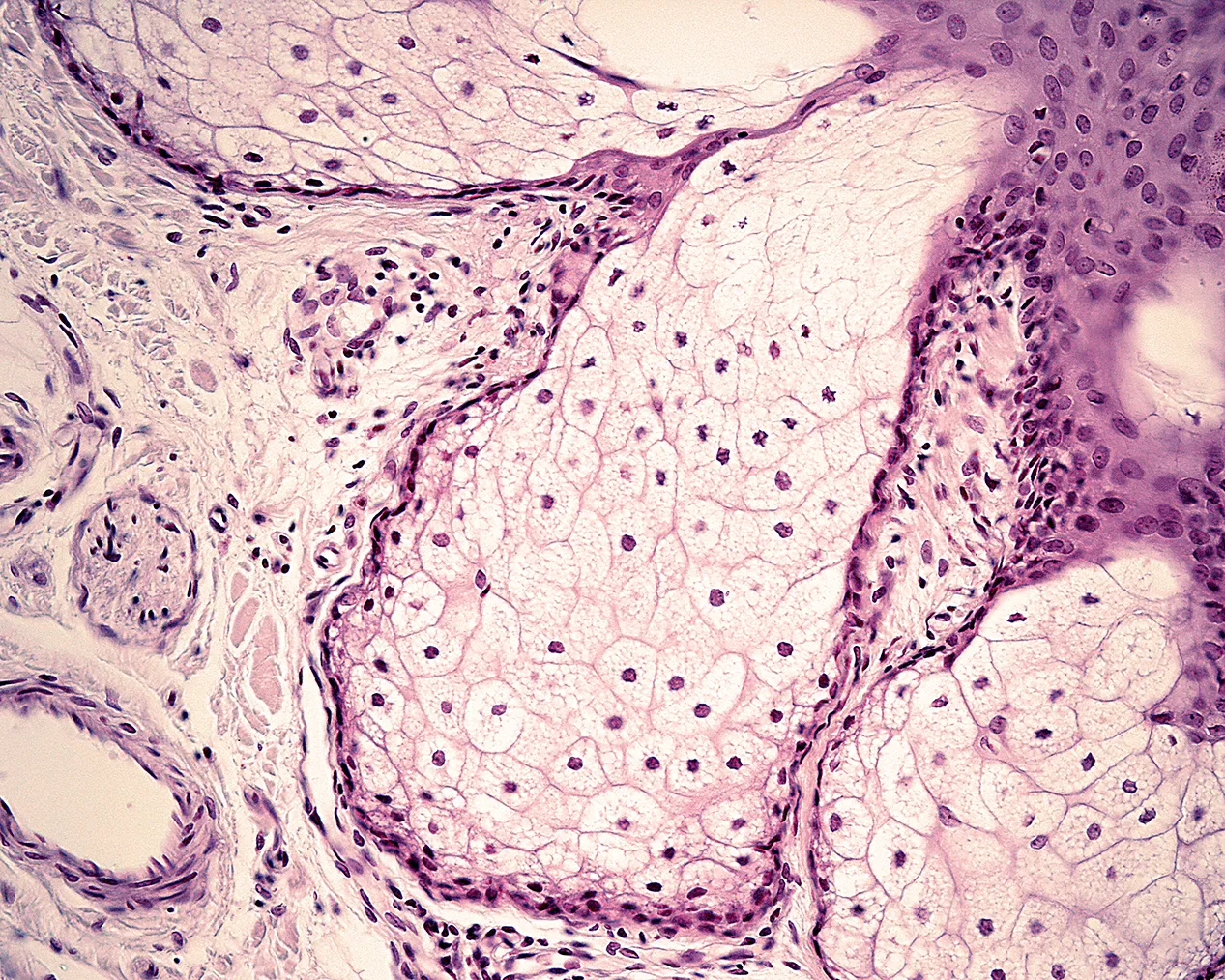 Tissue
